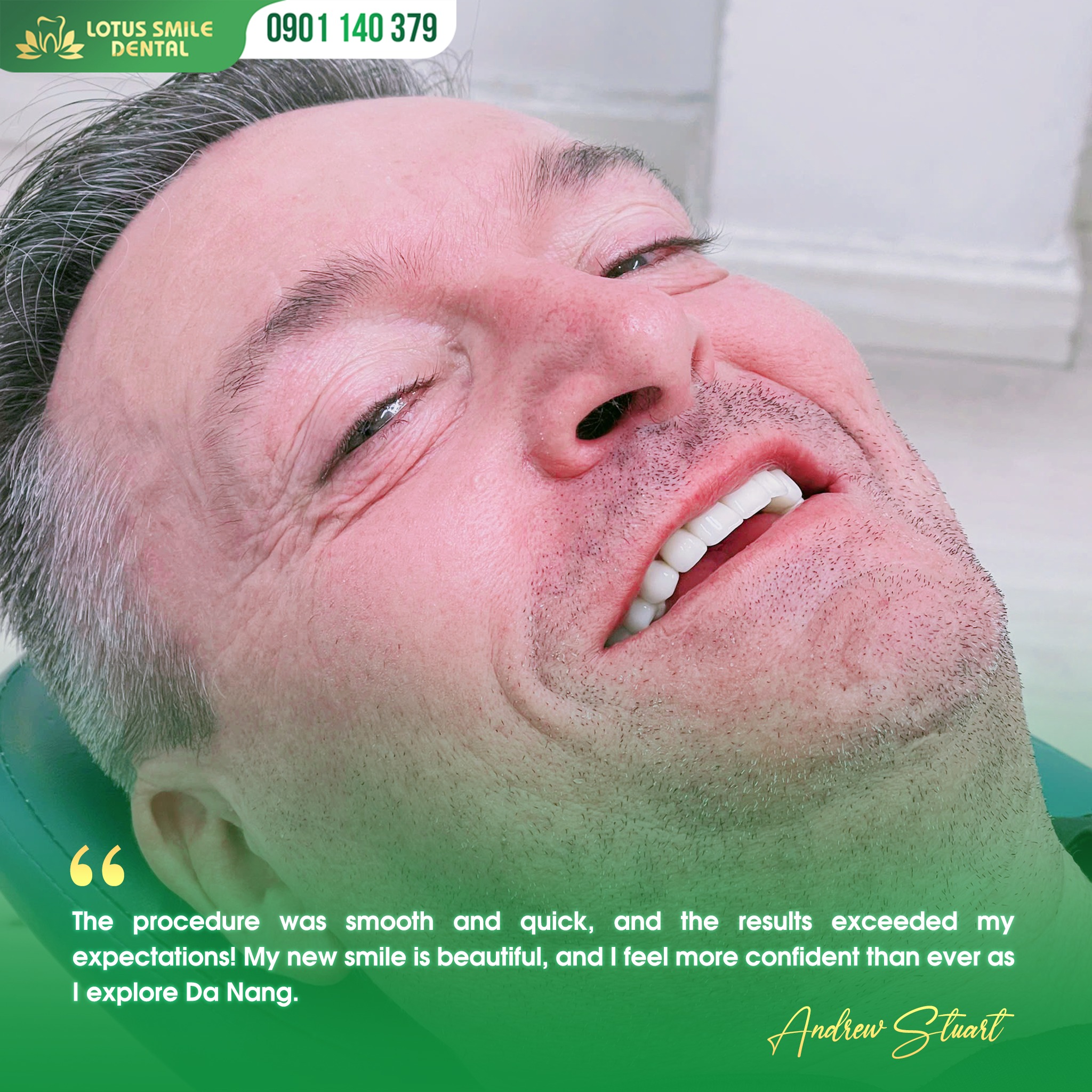 DaNangPorcelaindentalcrowns-BọcrăngsứĐàNẵng(8)