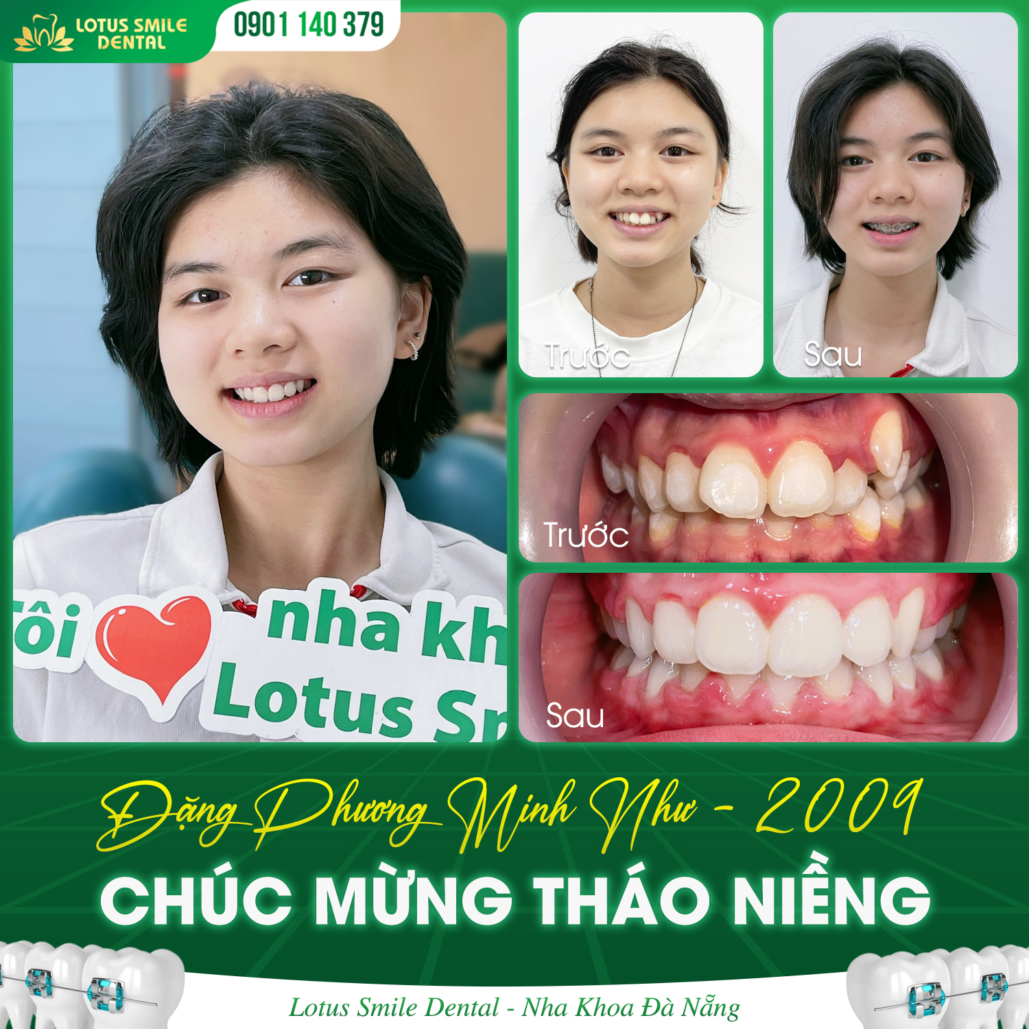 Niềngrăngthànhcông1
