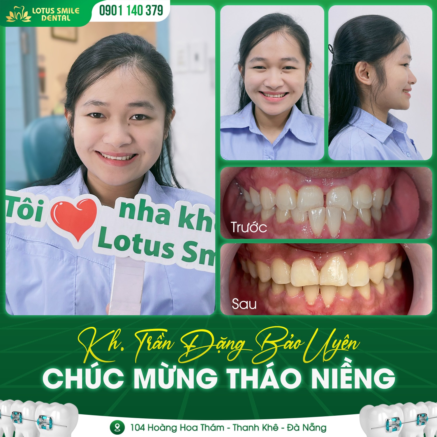 Niềngrăngthànhcông3
