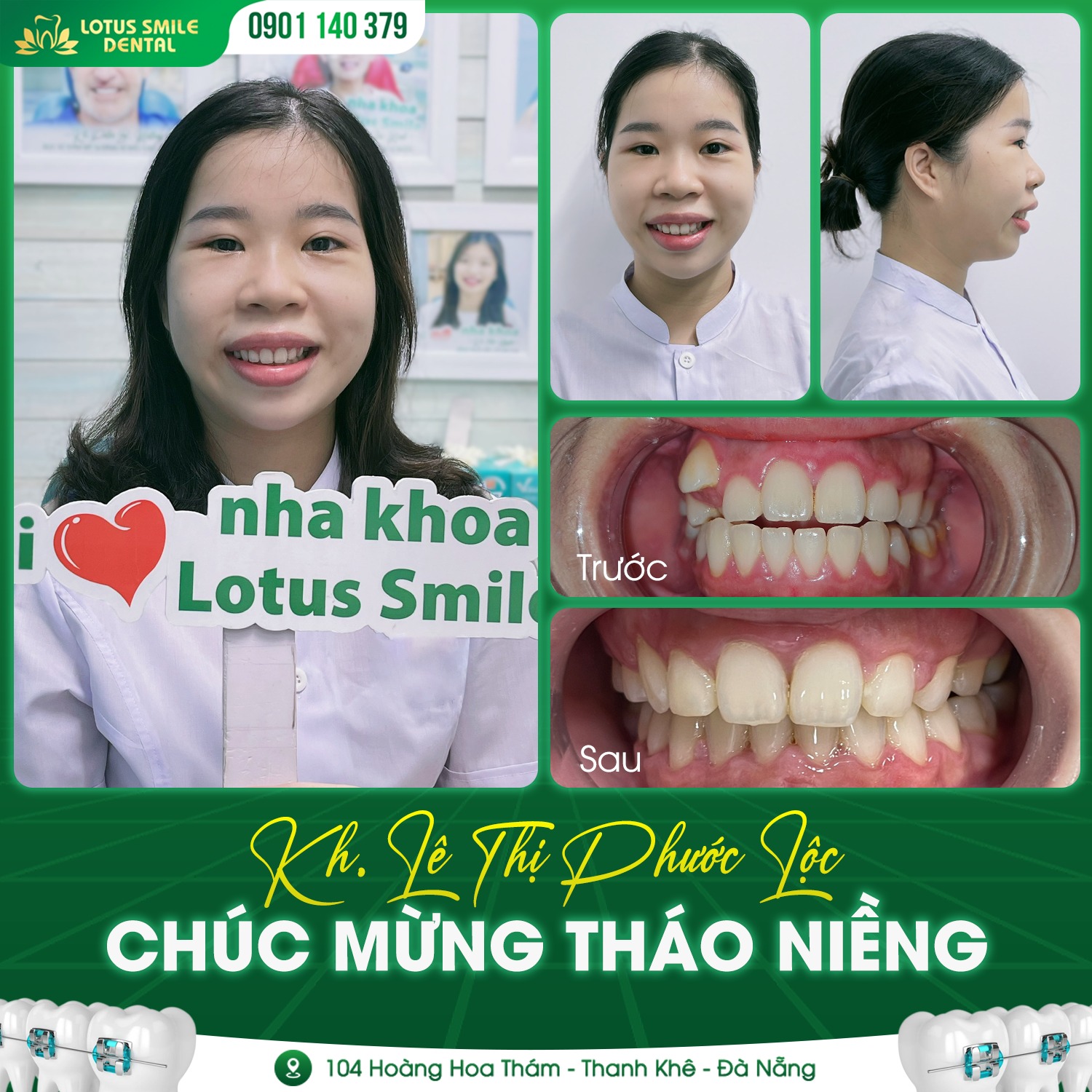 Niềngrăngthànhcông4