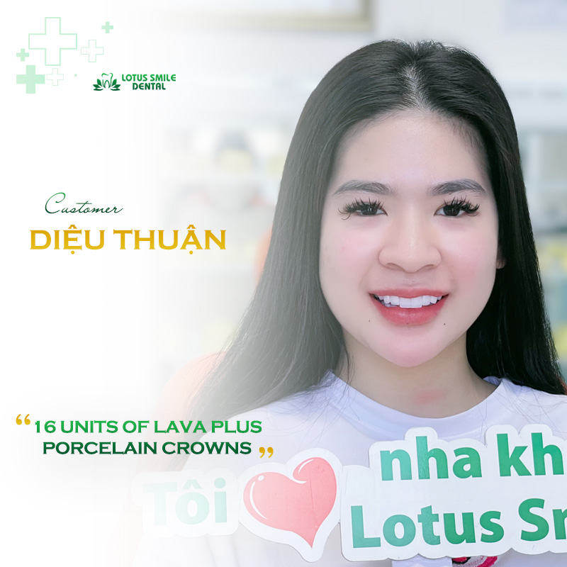 Khach-hang-lt-TA-4-non