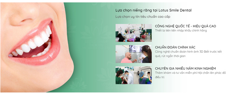 lua-chon-nieng-rang-tai-Lotus-Smile-Dental